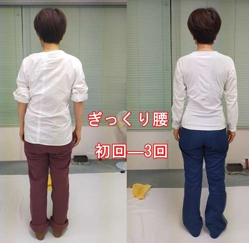 東浦町から来た『ぎっくり腰』のテニスプレーヤー